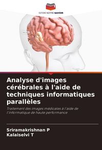 Produktbild: Analyse d'images c&eacute;r&eacute;brales &agrave; l'aide de techniques informatiques parall&egrave;les
