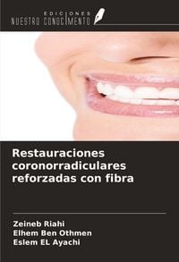 Produktbild: Restauraciones coronorradiculares reforzadas con fibra