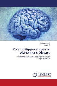 Produktbild: Role of Hippocampus in Alzheimer's Disease