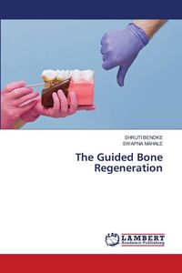 Produktbild: The Guided Bone Regeneration