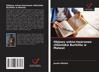 Produktbild: Objawy ustno-twarzowe ch&iquest;oniaka Burkitta w Malawi