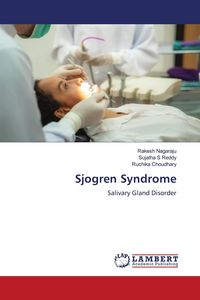 Produktbild: Sjogren Syndrome