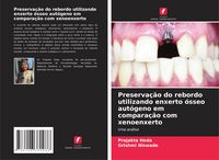 Produktbild: Preserva&ccedil;&atilde;o do rebordo utilizando enxerto &oacute;sseo aut&oacute;geno em compara&ccedil;&atilde;o com xenoenxerto