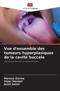 Produktbild: Vue d'ensemble des tumeurs hyperplasiques de la cavit&eacute; buccale