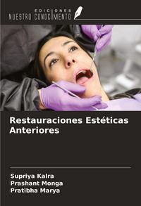 Produktbild: Restauraciones Est&eacute;ticas Anteriores