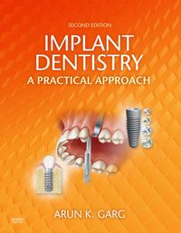 Produktbild: Implant Dentistry - E-Book