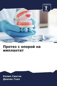 Produktbild: Protez s oporoj na implantat