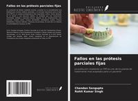 Produktbild: Fallos en las pr&oacute;tesis parciales fijas