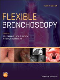 Produktbild: Flexible Bronchoscopy