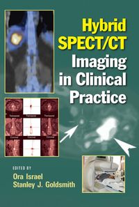 Produktbild: Hybrid SPECT/CT Imaging in Clinical Practice