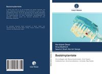 Produktbild: Basisimplantate