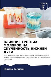 Produktbild: VLIYaNIE TRET'IH MOLYaROV NA SKUChENNOST' NIZhNEJ DUGI