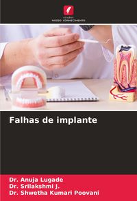 Produktbild: Falhas de implante