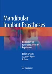 Produktbild: Mandibular Implant Prostheses
