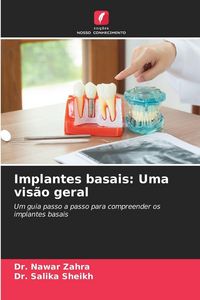 Produktbild: Implantes basais: Uma vis&atilde;o geral