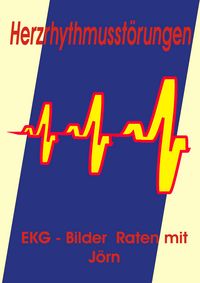 Produktbild: Herzrhythmusst&ouml;rungen