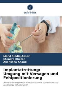 Produktbild: Implantatrettung: Umgang mit Versagen und Fehlpositionierung