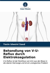 Produktbild: Behandlung von V-U-Reflux durch Elektrokoagulation