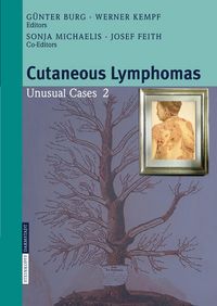 Produktbild: Cutaneous Lymphomas