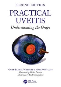 Produktbild: Practical Uveitis