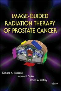 Produktbild: Image-Guided Radiation Therapy of Prostate Cancer