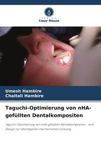 Produktbild: Taguchi-Optimierung von nHA-gef&uuml;llten Dentalkompositen