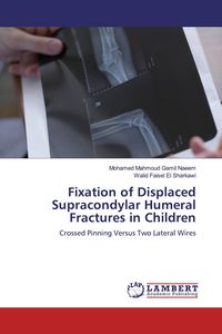 Produktbild: Fixation of Displaced Supracondylar Humeral Fractures in Children