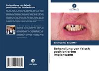 Produktbild: Behandlung von falsch positionierten Implantaten
