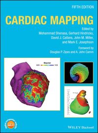 Produktbild: Cardiac Mapping