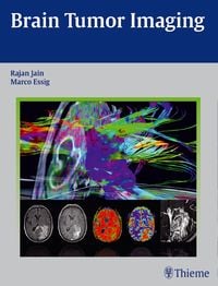 Produktbild: Brain Tumor Imaging