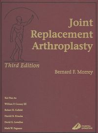 Produktbild: Joint Replacement Arthroplasty