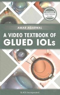 Produktbild: A Video Textbook of Glued IOLs