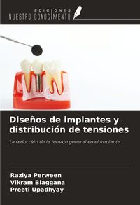 Produktbild: Dise&ntilde;os de implantes y distribuci&oacute;n de tensiones
