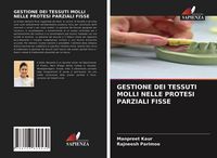 Produktbild: Gestione Dei Tessuti Molli Nelle Protesi Parziali Fisse