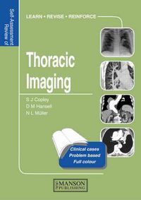 Produktbild: Thoracic Imaging