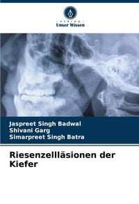 Produktbild: Riesenzelll&auml;sionen der Kiefer