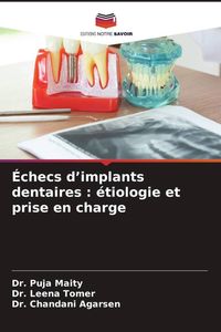 Produktbild: &Eacute;checs d'implants dentaires : &eacute;tiologie et prise en charge