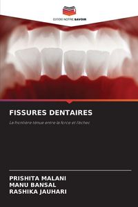 Produktbild: Fissures Dentaires