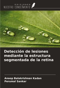 Produktbild: Detecci&oacute;n de lesiones mediante la estructura segmentada de la retina