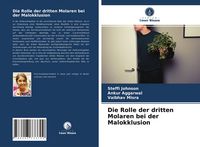 Produktbild: Die Rolle der dritten Molaren bei der Malokklusion