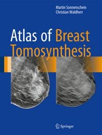 Produktbild: Atlas of Breast Tomosynthesis
