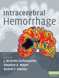 Produktbild: Intracerebral Hemorrhage