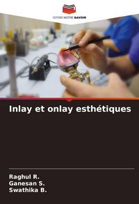 Produktbild: Inlay et onlay esth&eacute;tiques