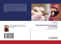 Produktbild: Periodontal Plastic Surgery in Dentistry