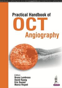 Produktbild: Practical Handbook of OCT Angiography