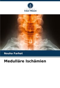 Produktbild: Medull&auml;re Isch&auml;mien