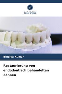 Produktbild: Restaurierung von endodontisch behandelten Z&auml;hnen