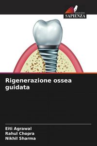 Produktbild: Rigenerazione ossea guidata