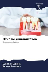 Produktbild: Otkazy implantatow
