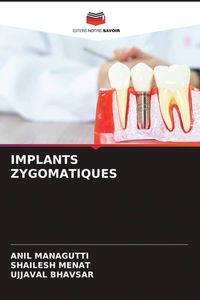 Produktbild: Implants Zygomatiques